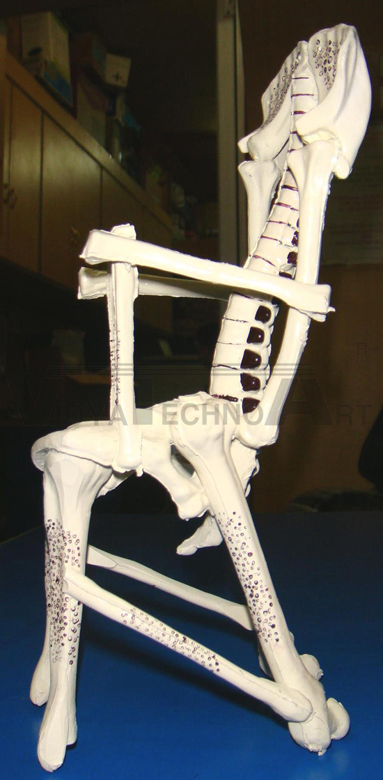 Chair Osteoporesis